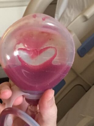 "Heart-shaped blood in surgical drain as a symbol of faith and healing during sepsis recovery"